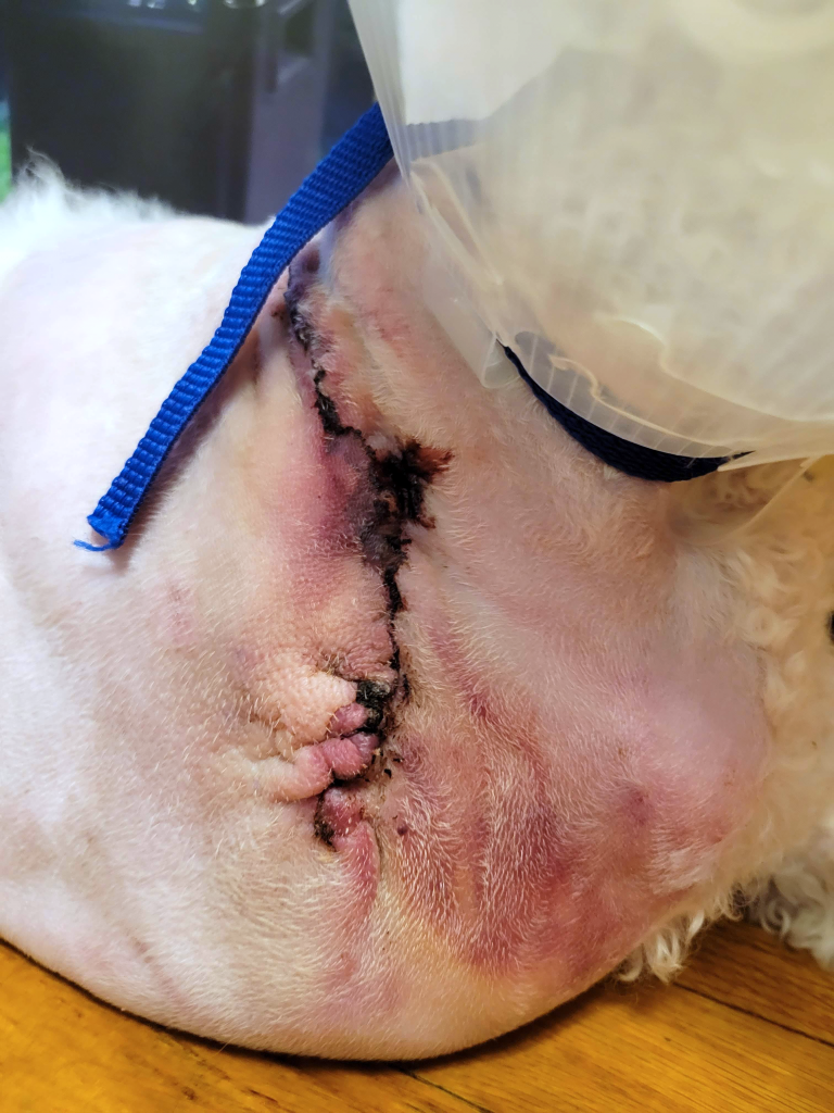 Shakira's surgical scar